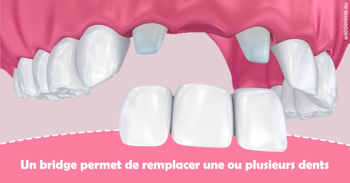 https://dr-infante-christian.chirurgiens-dentistes.fr/Bridge remplacer dents 2