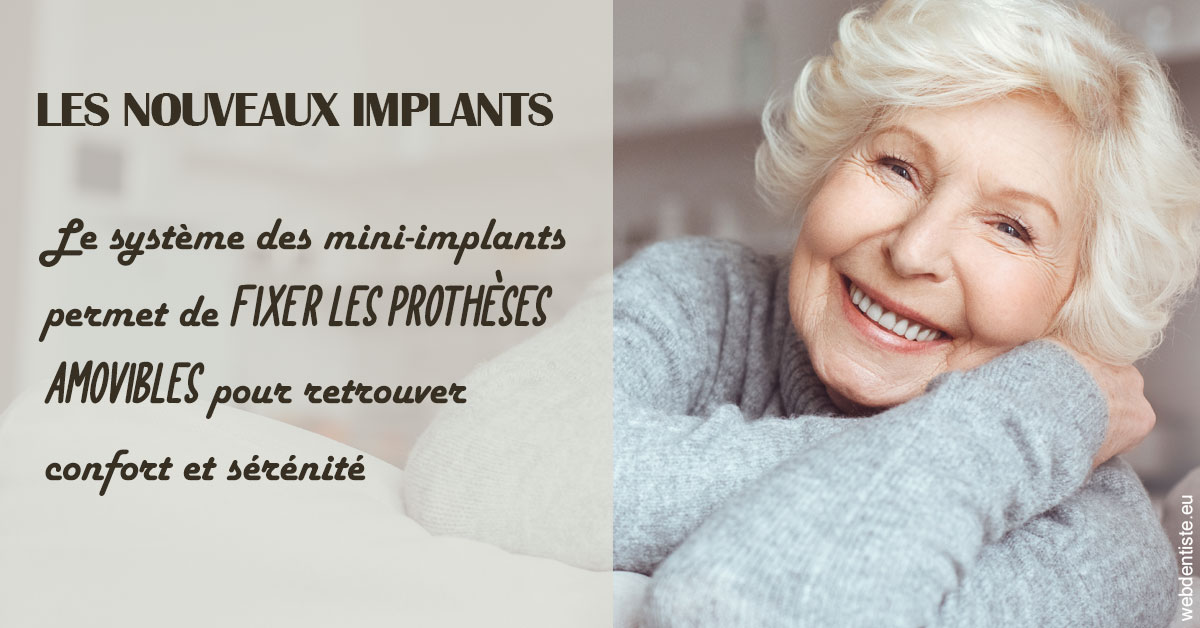 https://dr-infante-christian.chirurgiens-dentistes.fr/Les nouveaux implants 1