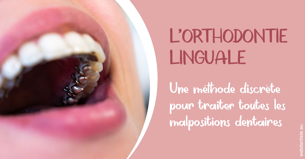 https://dr-infante-christian.chirurgiens-dentistes.fr/L'orthodontie linguale 2