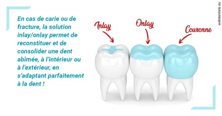 https://dr-infante-christian.chirurgiens-dentistes.fr/L'INLAY ou l'ONLAY