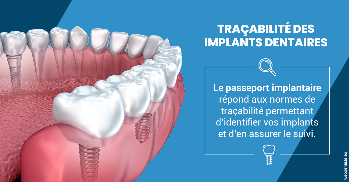 https://dr-infante-christian.chirurgiens-dentistes.fr/T2 2023 - Traçabilité des implants 1