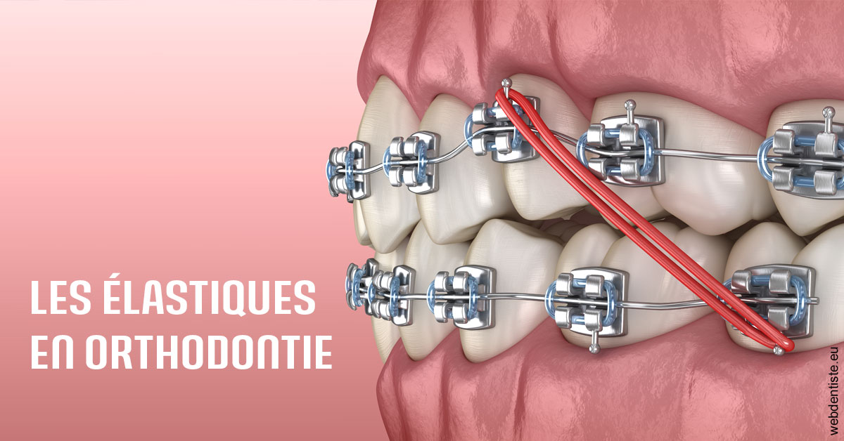 https://dr-infante-christian.chirurgiens-dentistes.fr/Elastiques orthodontie 2