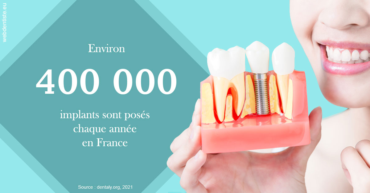 https://dr-infante-christian.chirurgiens-dentistes.fr/Pose d'implants en France 2